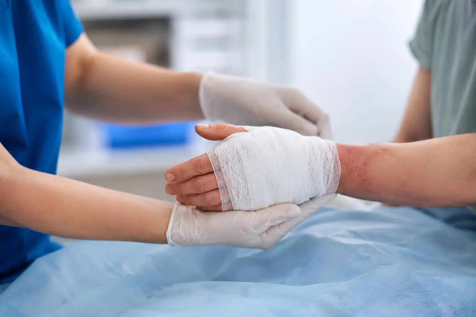 Burn Injuries